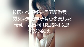 专注人前露出与路人同框美腿女神GI9ZA视图集，公园超市广场哪人多往哪去和老登一起锻炼 (2)